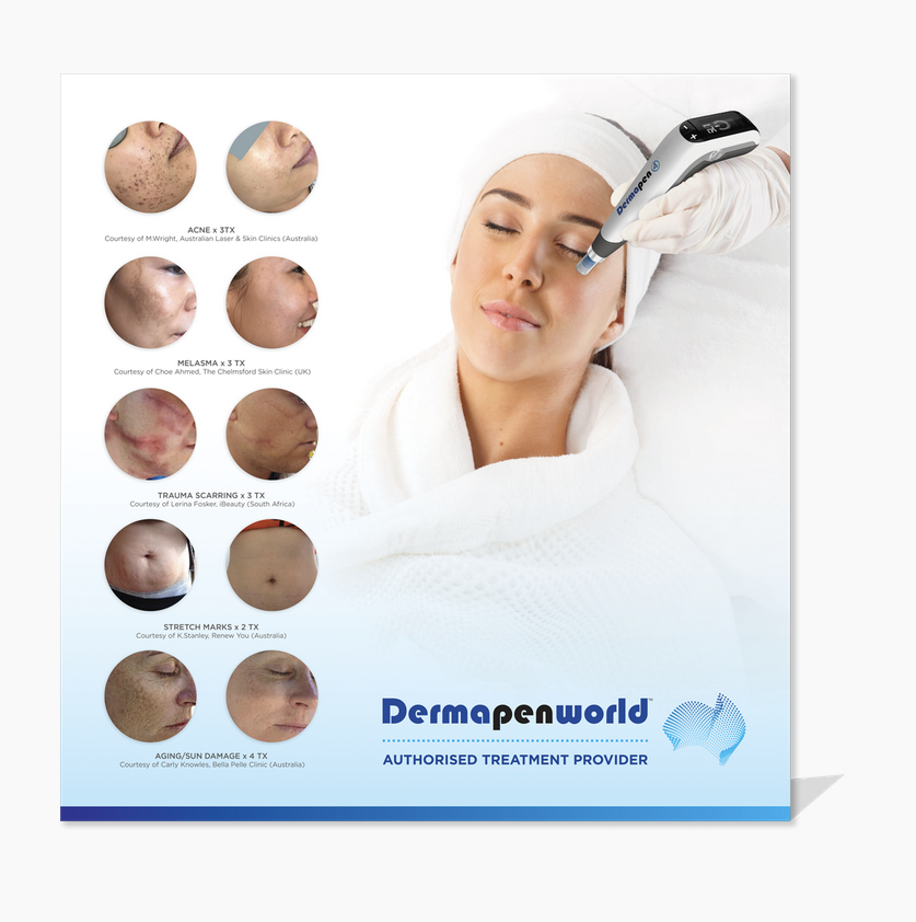 Dermapen4 Rückwand Thekensteller, leer