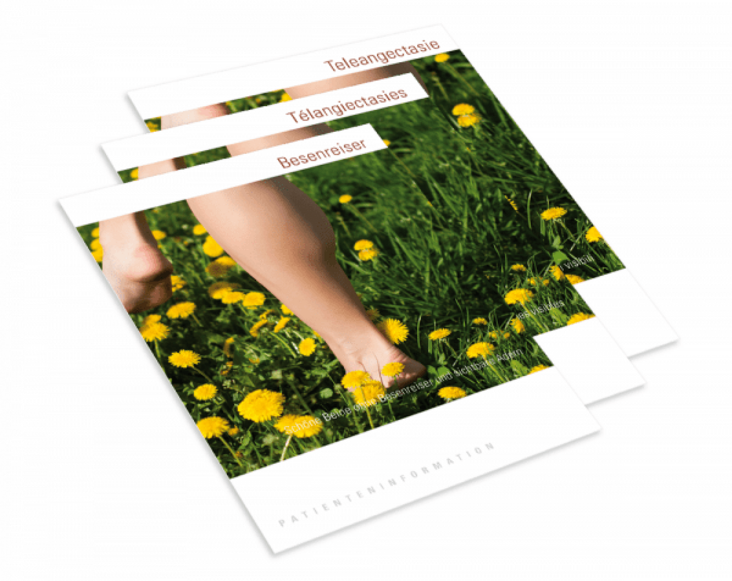 Brochure pour patients Télangiectasies IPL/Laser YAG'